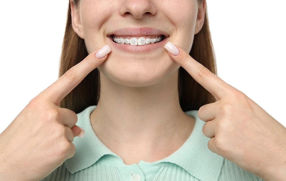 Invisalign Treatment va