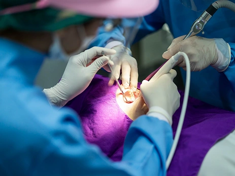root canal treatment