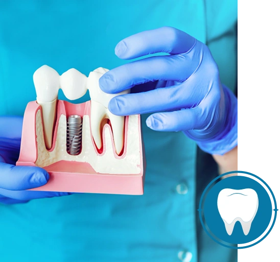 dental-implants arlington