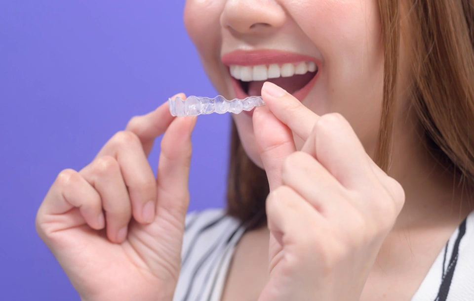 invisalign-treatment in arlington va