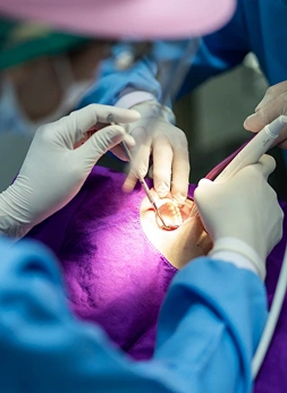 pulpotomy and endodontics