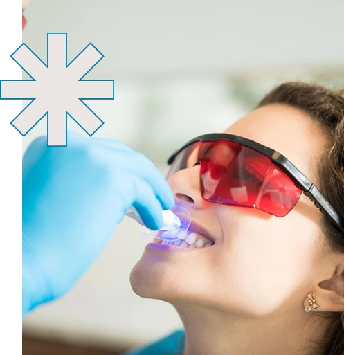 Teeth Whitening in arlington va