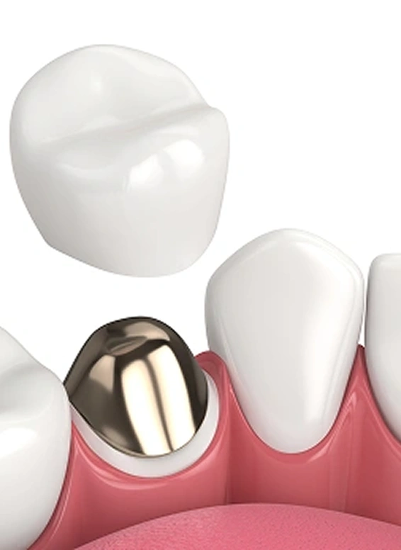 tooth and endodontics