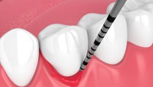 Professional Periodontics Treatment in Arlington, VA