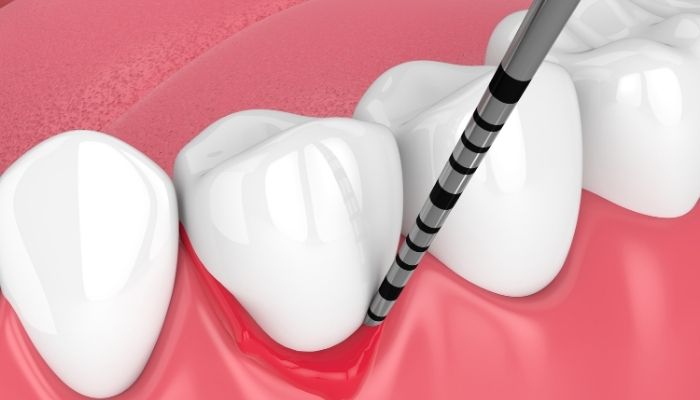 Professional Periodontics Treatment in Arlington, VA